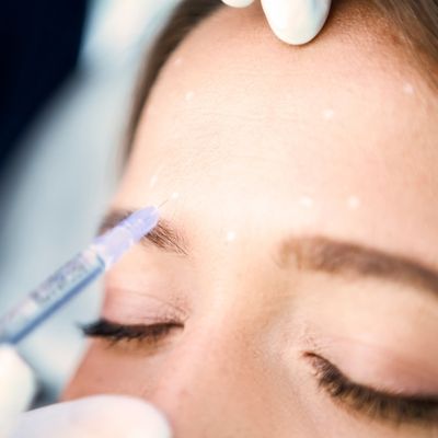 frown lines procedure
