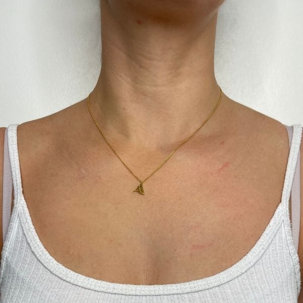 neck & platysmal bands 2b