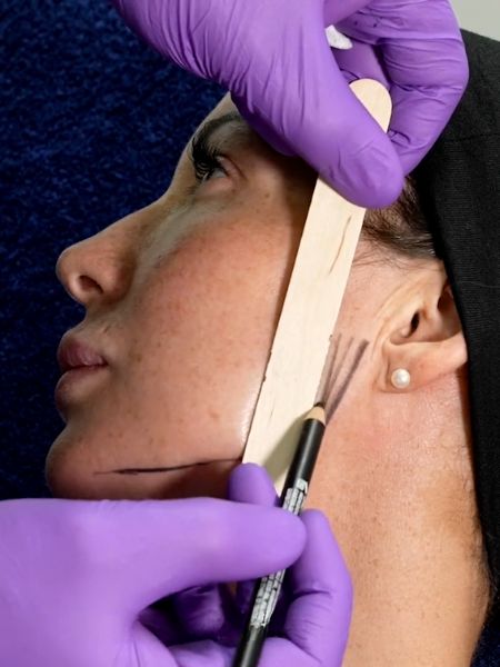 Jawline Slimming Masseter Botox Training