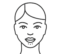 Facial diagram of chin dimpling