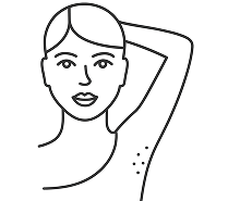 Facial diagram of Hyperhidrosis